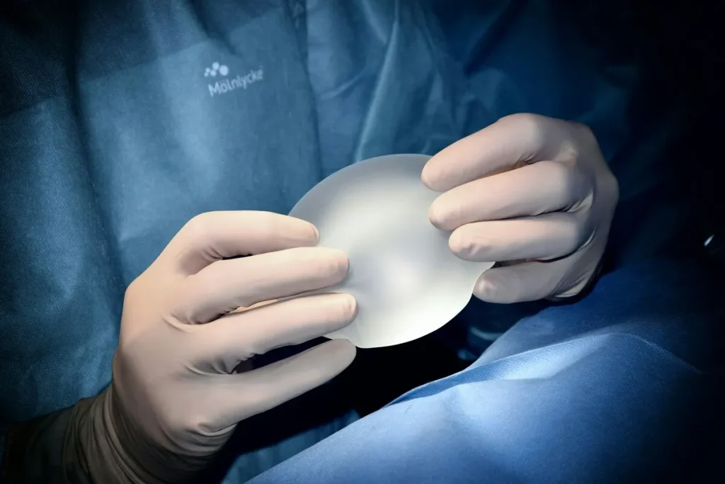 Mãos de um cirurgião com luvas segurando um implante de silicone mamário. A imagem em close-up mostra o material translúcido do implante e as luvas cirúrgicas, com o uniforme médico visível ao fundo.